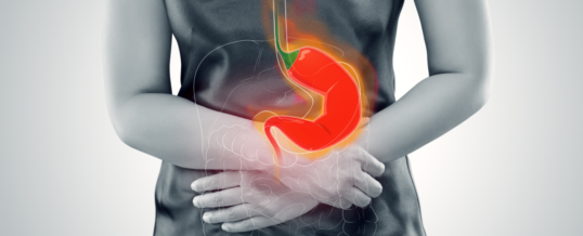 Acid Reflux: Natural Relief And Prevention